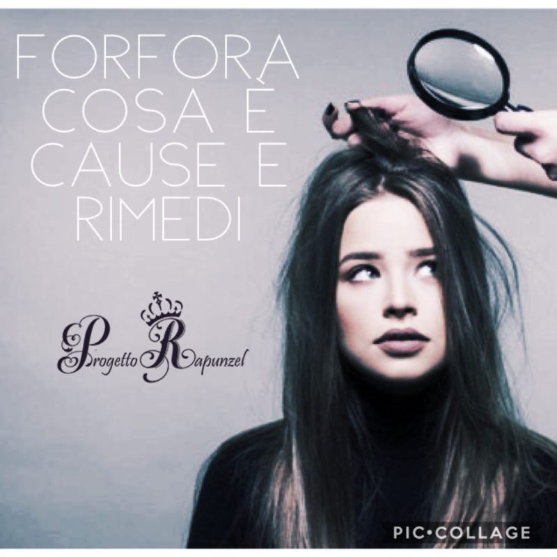 La Forfora – Cosa è, cause e rimedi